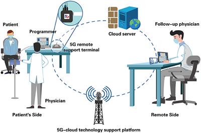 Application of Postoperative Remote Follow-Up of CIED Based on the 5G Cloud Technology Support Platform in Areas With Underdeveloped Medical Resources